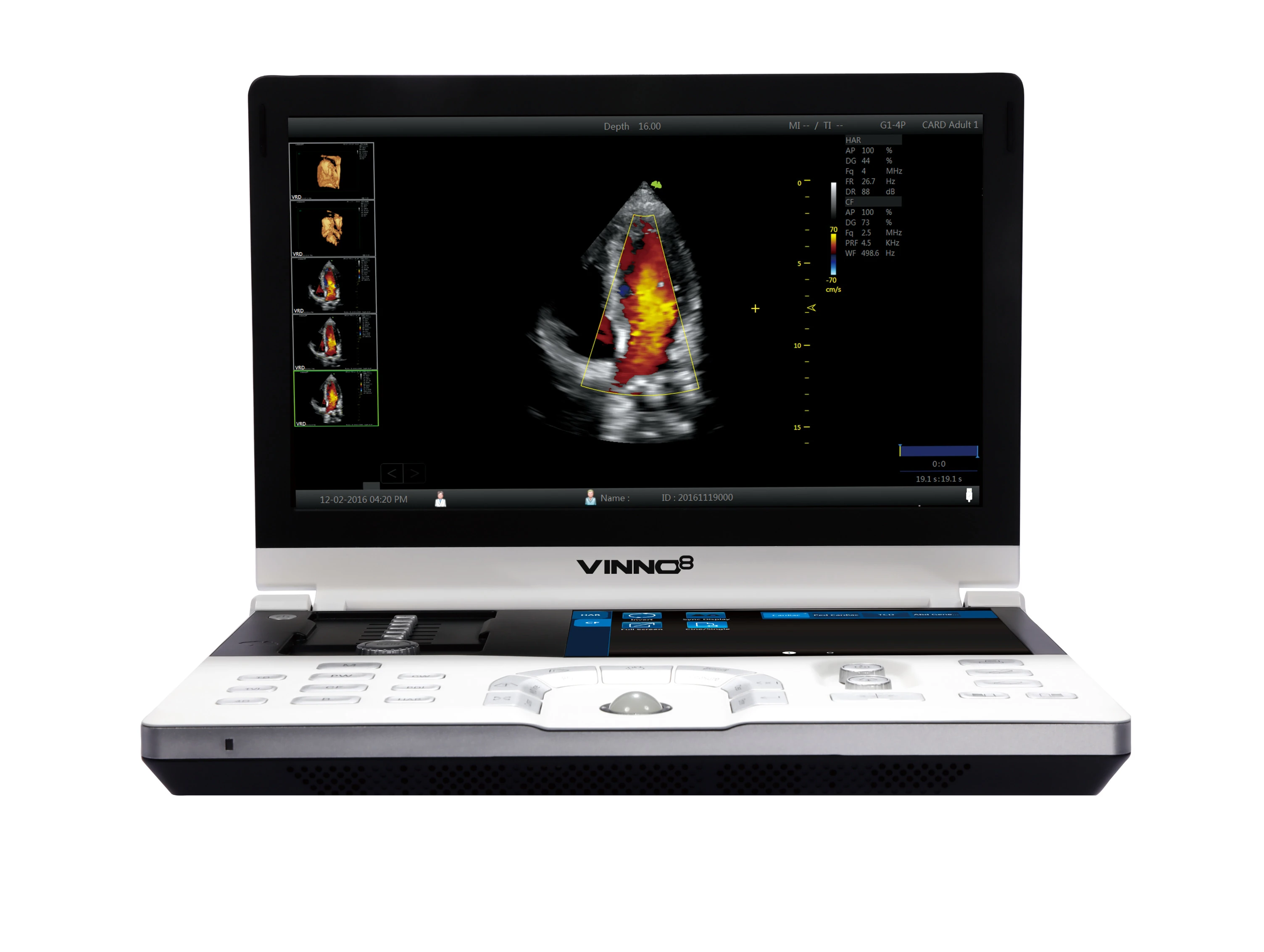 Ultrasound Machine